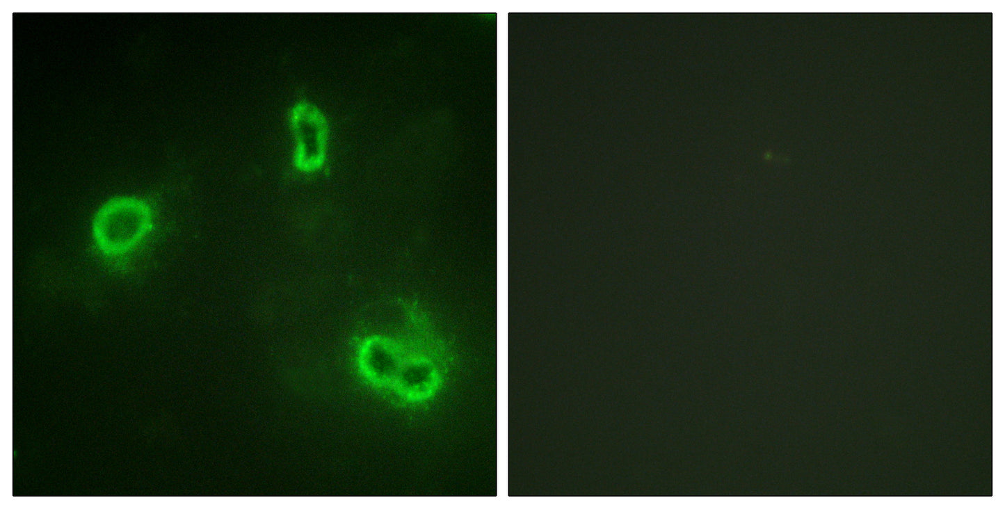 Rsk-1 Rabbit Polyclonal Antibody