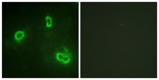 Rsk-1 Rabbit Polyclonal Antibody