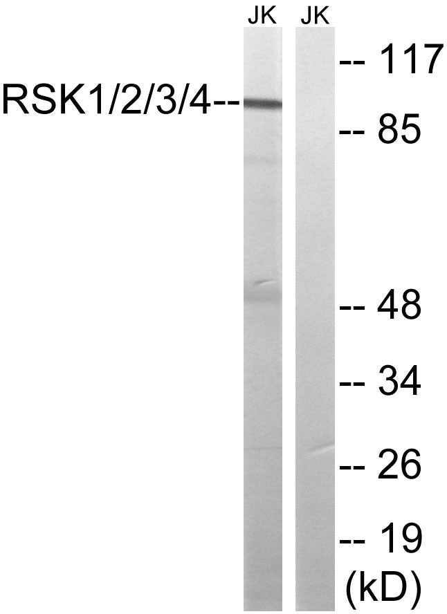 Rsk-1/2/3/4 Rabbit Polyclonal Antibody