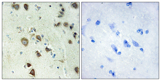 Rsk-4 Rabbit Polyclonal Antibody
