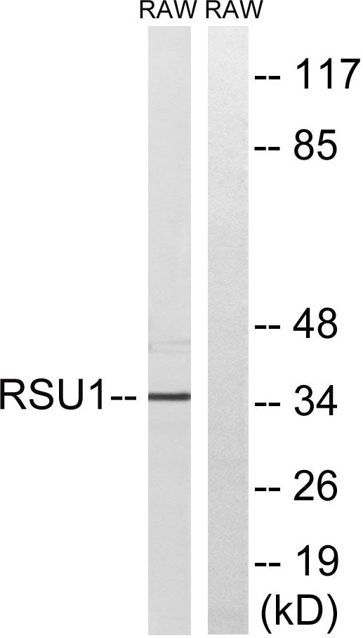 Rsu-1 Rabbit Polyclonal Antibody