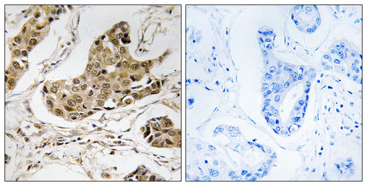 RTCD1 Rabbit Polyclonal Antibody