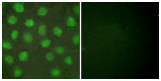 RXRγ Rabbit Polyclonal Antibody