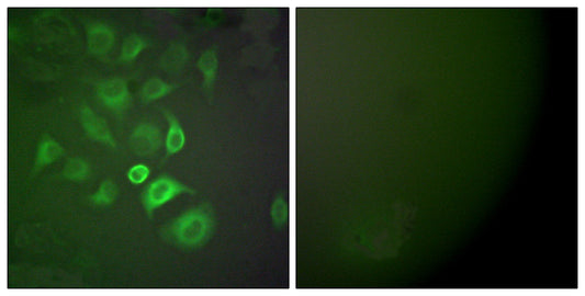 S-100 α Rabbit Polyclonal Antibody