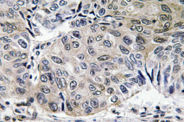 S-100A10 Rabbit Polyclonal Antibody