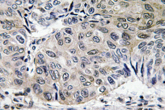 S-100A10 Rabbit Polyclonal Antibody