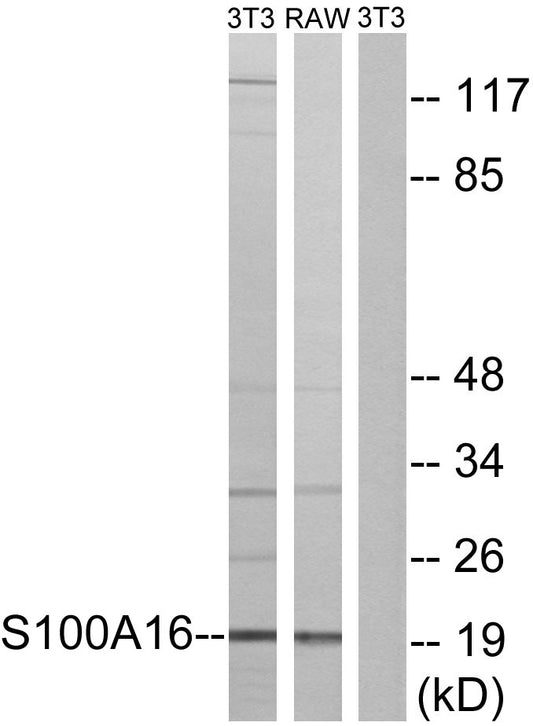 S-100A16 Rabbit Polyclonal Antibody