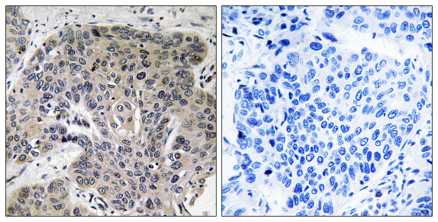 S-100A3 Rabbit Polyclonal Antibody
