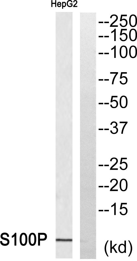 S-100P Rabbit Polyclonal Antibody