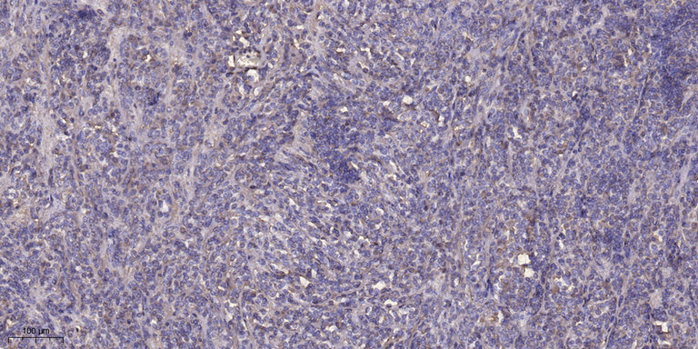 SACS Rabbit Polyclonal Antibody