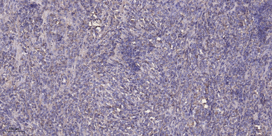 SACS Rabbit Polyclonal Antibody