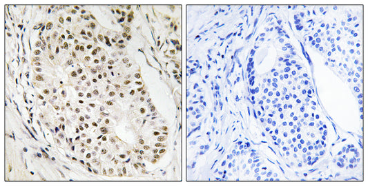 SAF-A2 Rabbit Polyclonal Antibody