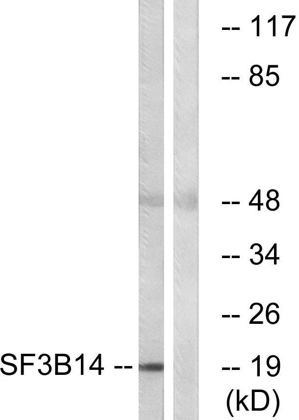 SAP 14 Rabbit Polyclonal Antibody