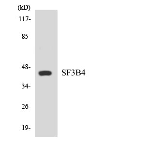 SAP 49 Rabbit Polyclonal Antibody