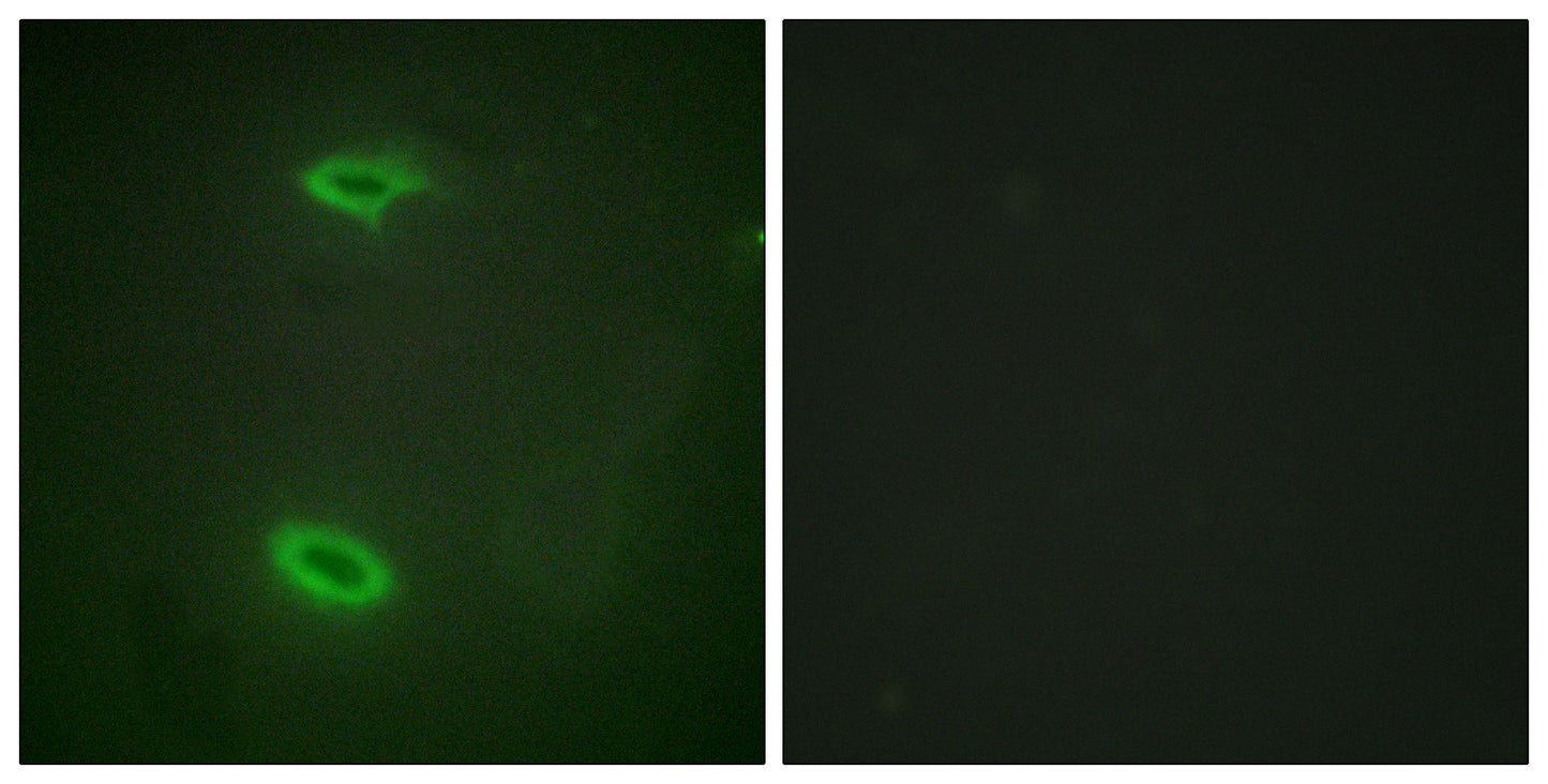 SAPAP1 Rabbit Polyclonal Antibody