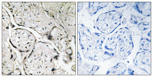 Sar1B Rabbit Polyclonal Antibody