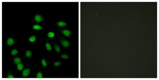 SCAND1 Rabbit Polyclonal Antibody