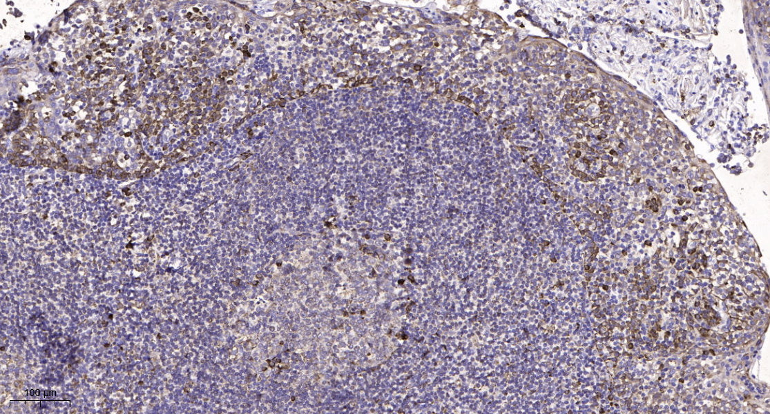 SCN1A Rabbit Polyclonal Antibody