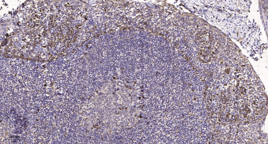 SCN1A Rabbit Polyclonal Antibody