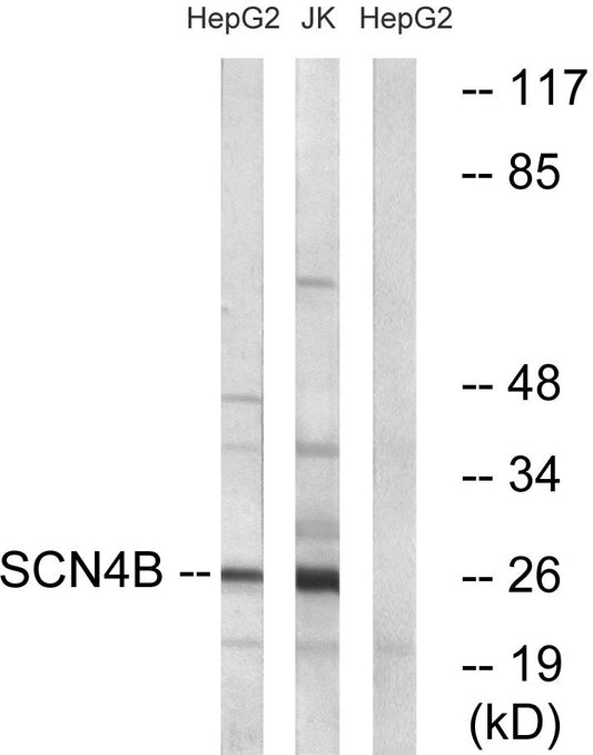 Scn4b Rabbit Polyclonal Antibody