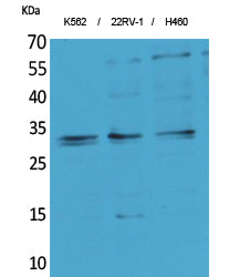 SCP-3 Rabbit Polyclonal Antibody
