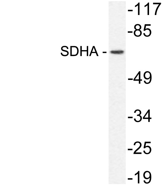 SDHA Rabbit Polyclonal Antibody