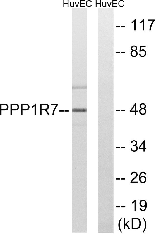 Sds22 Rabbit Polyclonal Antibody