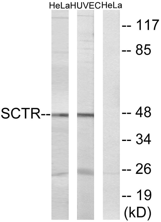 Secretin Receptor Rabbit Polyclonal Antibody