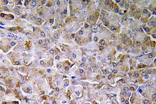 SEMA3C Rabbit Polyclonal Antibody