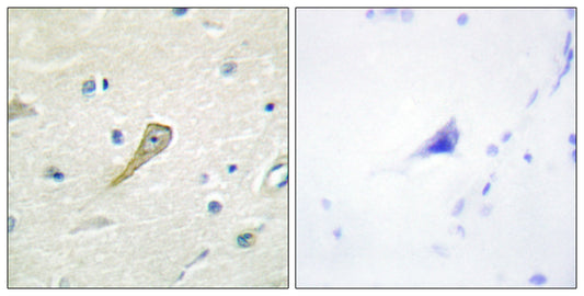 SEMA4A Rabbit Polyclonal Antibody