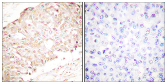 SENP1 Rabbit Polyclonal Antibody