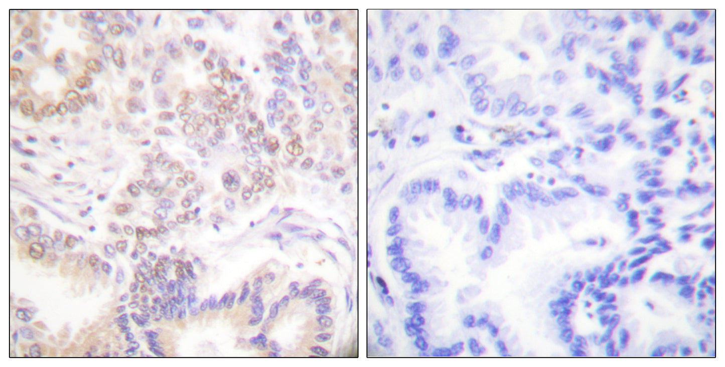 SENP5 Rabbit Polyclonal Antibody