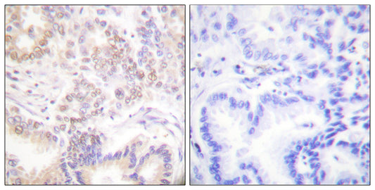 SENP5 Rabbit Polyclonal Antibody
