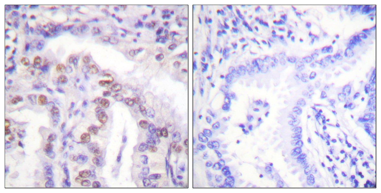 SENP6 Rabbit Polyclonal Antibody
