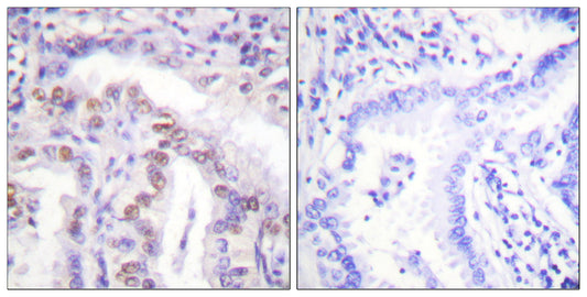 SENP6 Rabbit Polyclonal Antibody
