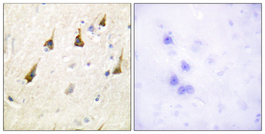 SENP7 Rabbit Polyclonal Antibody