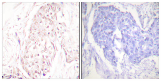 SENP8 Rabbit Polyclonal Antibody