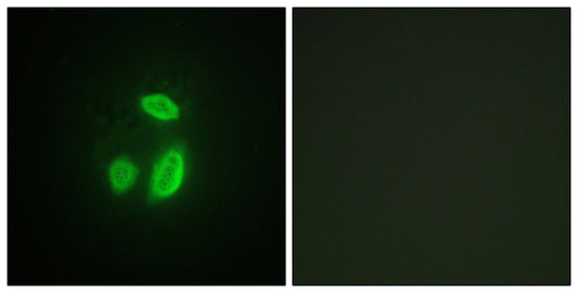 Separase Rabbit Polyclonal Antibody