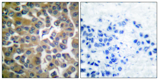 Seprase Rabbit Polyclonal Antibody