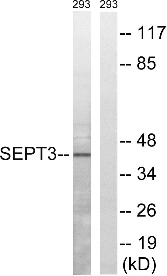 Septin 3 Rabbit Polyclonal Antibody