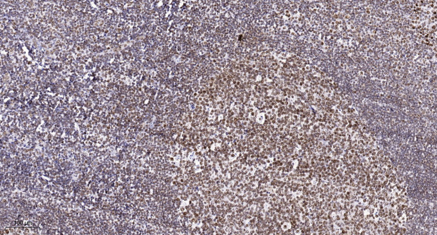 SETMAR Rabbit Polyclonal Antibody