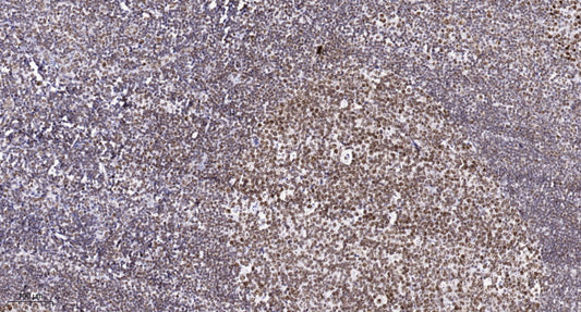 SETMAR Rabbit Polyclonal Antibody