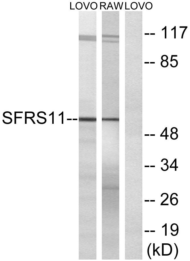 SFRS11 Rabbit Polyclonal Antibody