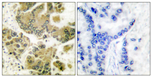 SGK1 Rabbit Polyclonal Antibody