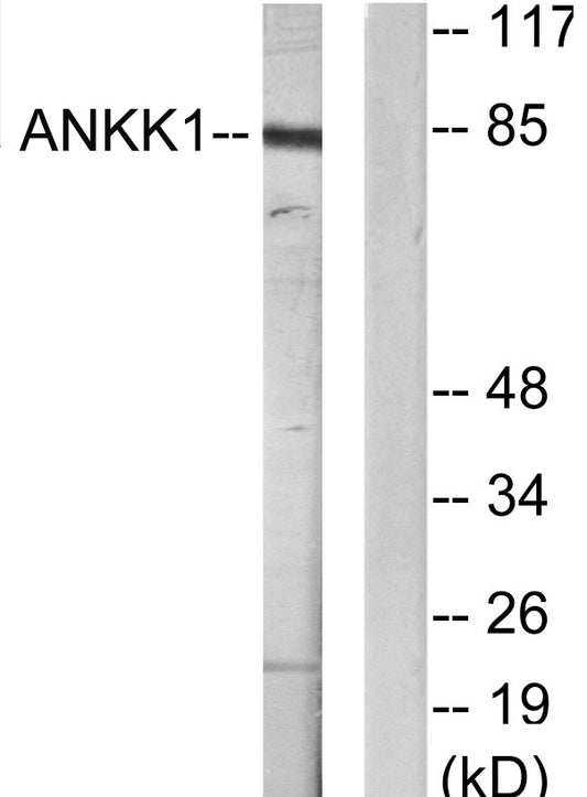 SgK288 Rabbit Polyclonal Antibody