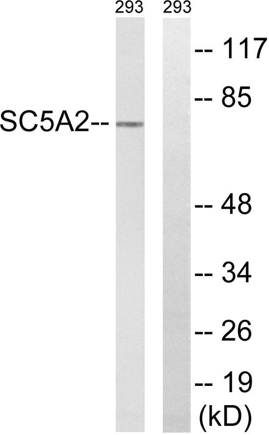SGLT-2 Rabbit Polyclonal Antibody