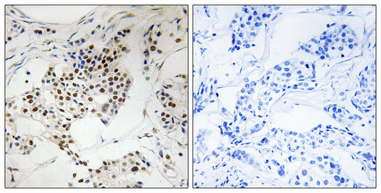 Sgo2 Rabbit Polyclonal Antibody