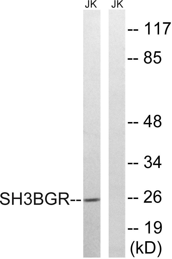 SH3BGR Rabbit Polyclonal Antibody
