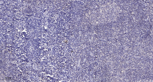 SH3BGRL3 Rabbit Polyclonal Antibody