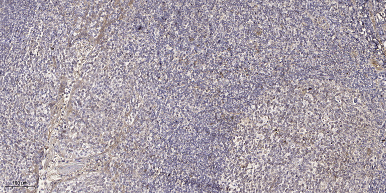 SH3TC2 Rabbit Polyclonal Antibody